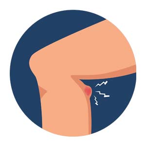 why-does-my-knee-hurt-04