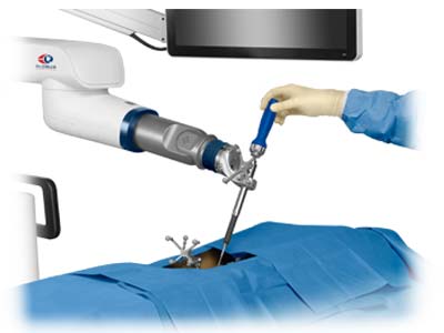 excelsius-gps-questions-to-ask-your-surgeon excelsius-gps-questions-to-ask-your-surgeon